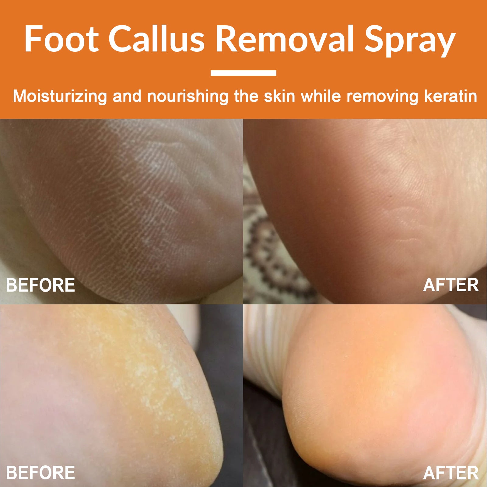 South Moon Foot Exfoliating Spray