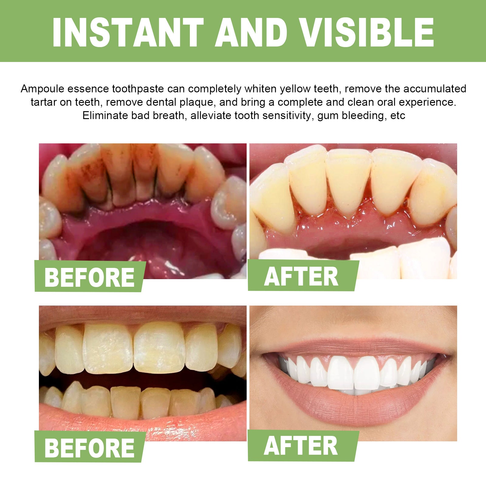EELHOE Teeth Whitening Essenceg